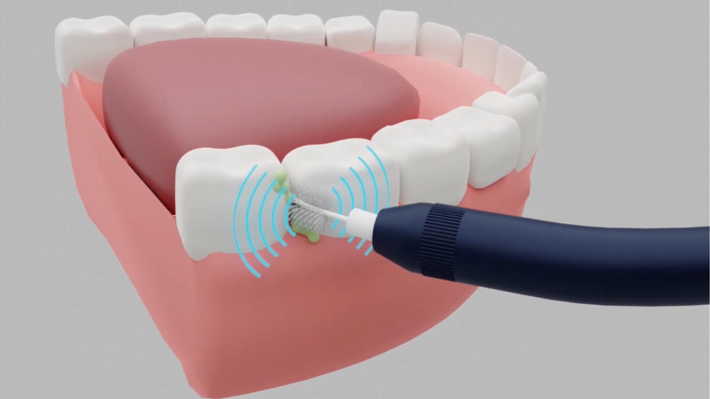 クラウドファンディングプロジェクト：UVクリーナーとマイクロファンでいつでも新品同様衛生的！2Way音波ブラシセット