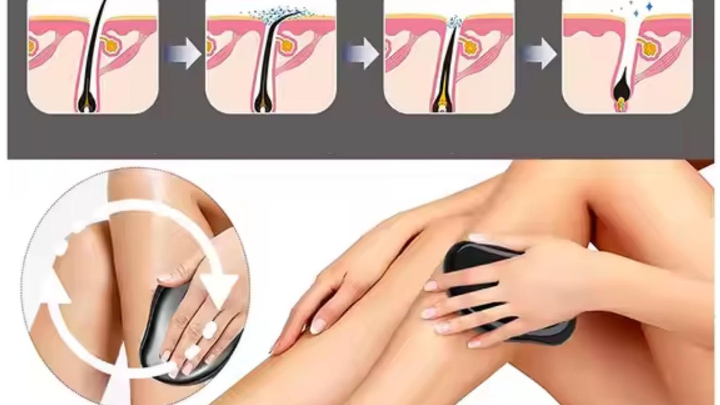 クラウドファンディングプロジェクト：男性の濃いムダ毛の処理や角質除去もできる！優しくなでるだけで脱毛できる脱毛パッド