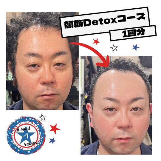 [限定3枠]B.bond Sakuraの顔筋もみほぐしを受けれる権