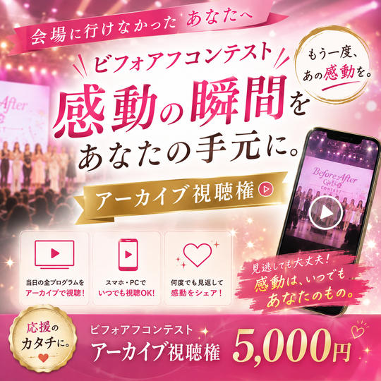アーカイブ視聴権